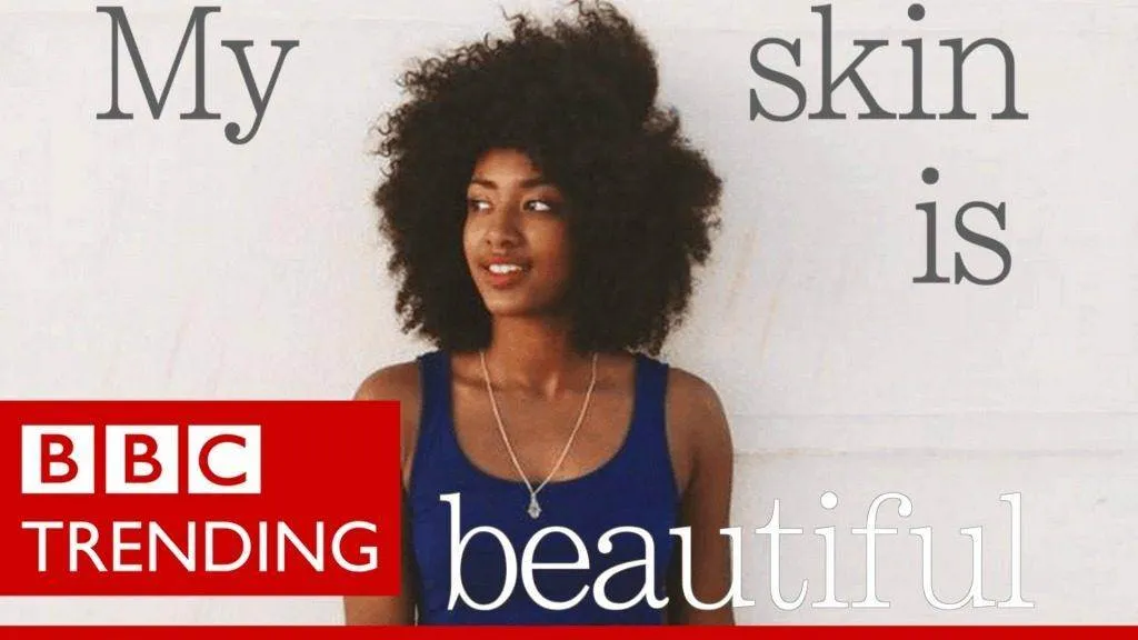 Video: This Is Why #FlexinMyComplexion Is Important